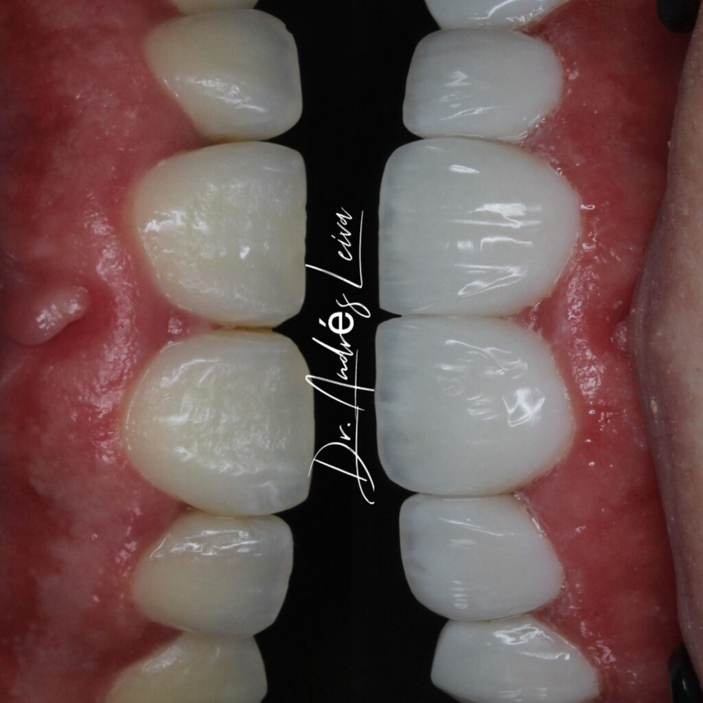 W Odontología Estética