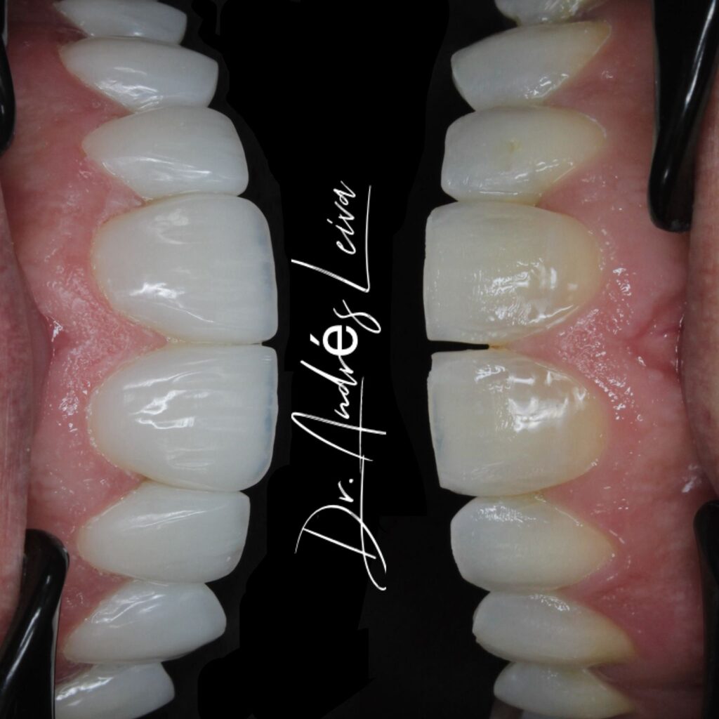 W Odontología Estética
