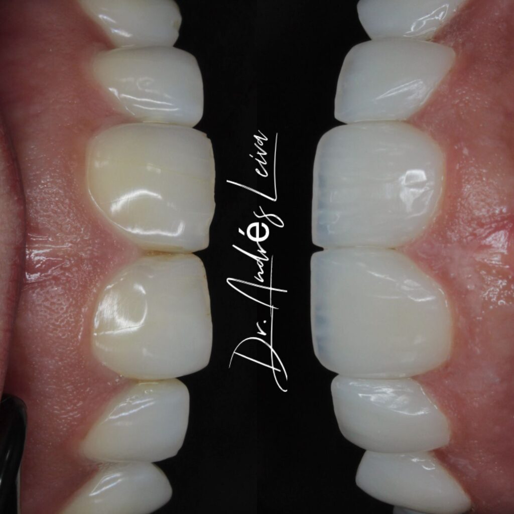 W Odontología Estética
