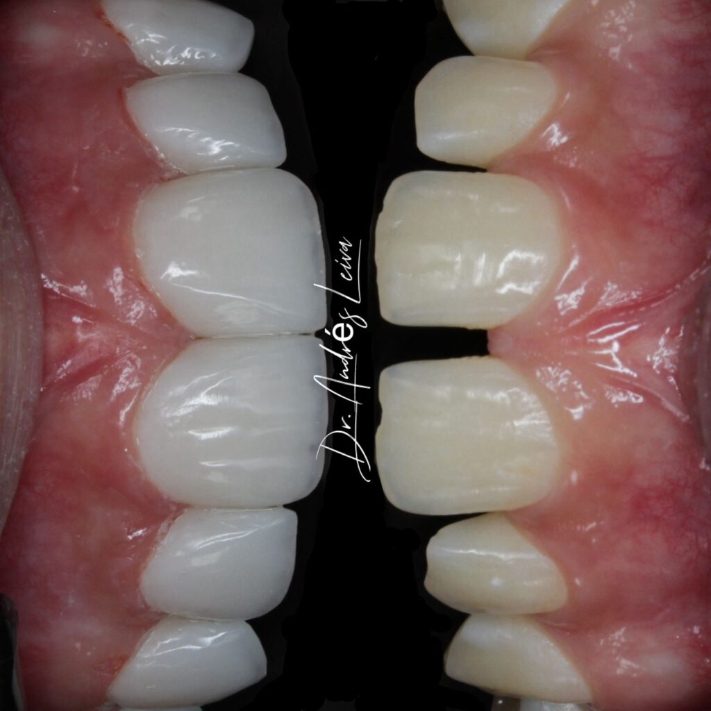 W Odontología Estética