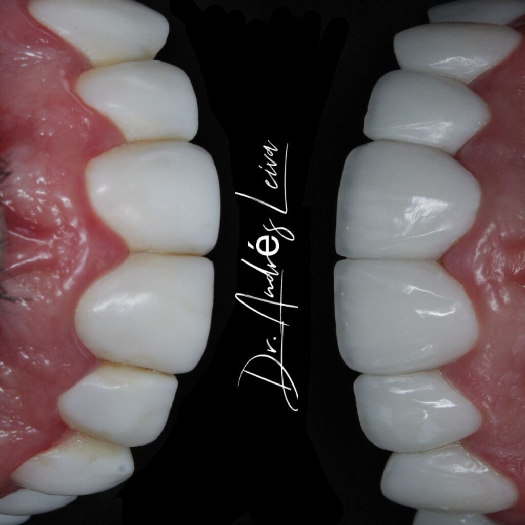 W Odontología Estética