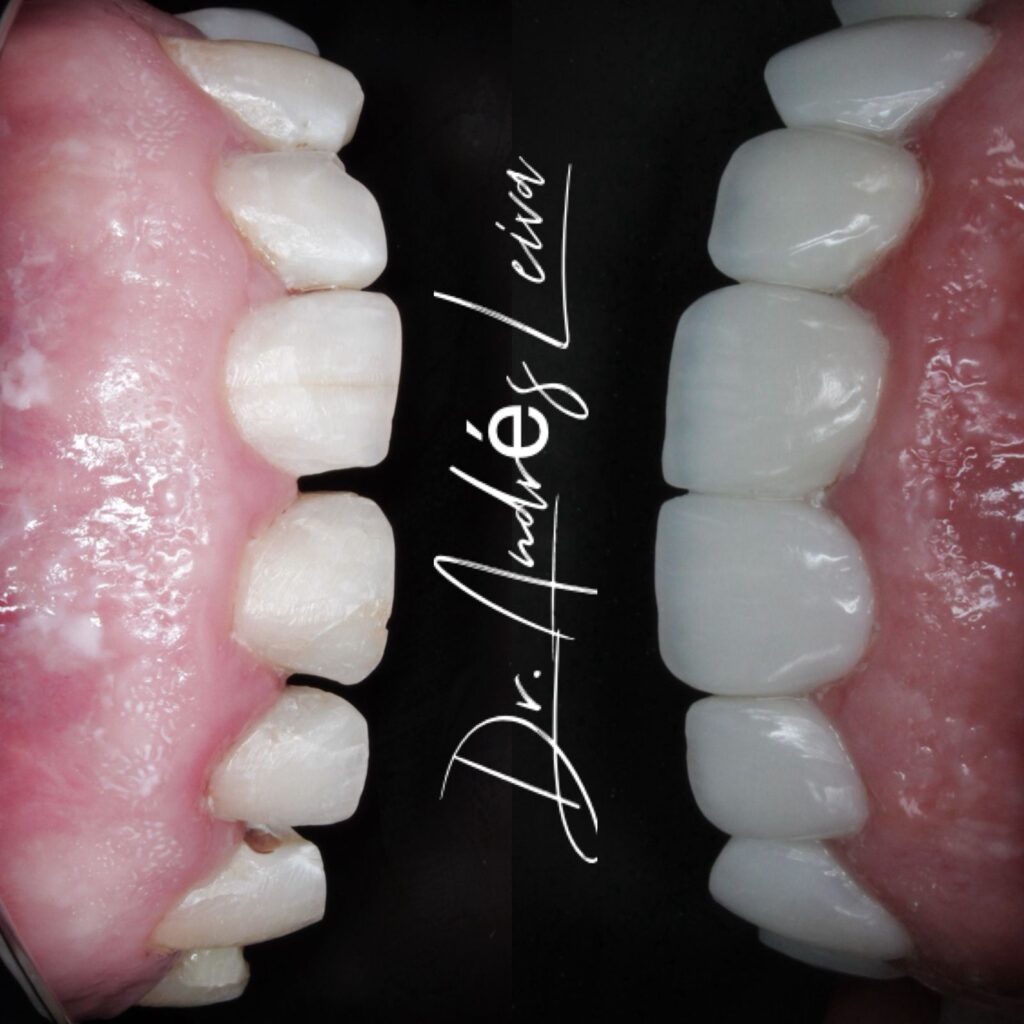 W Odontología Estética