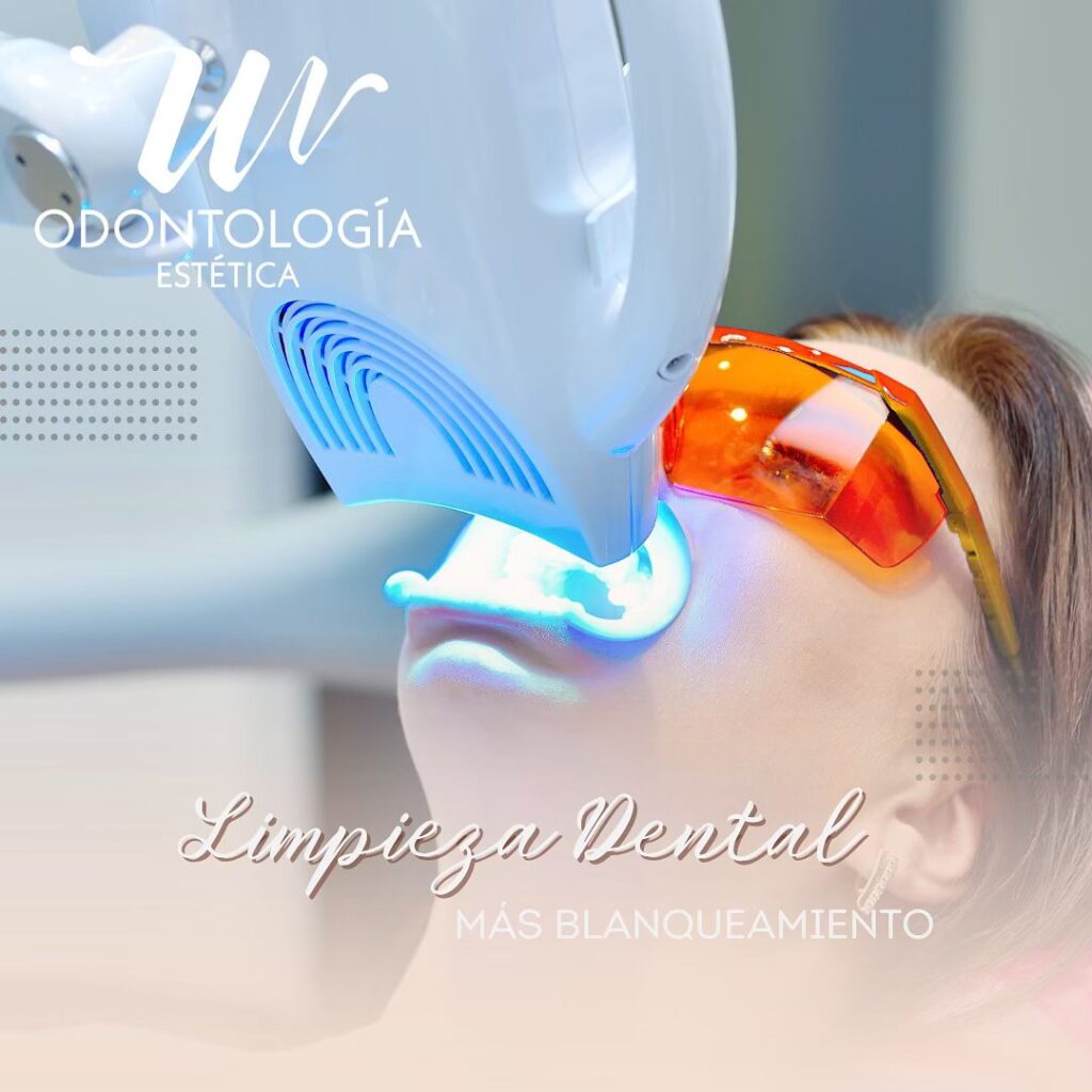 Limpieza Dental