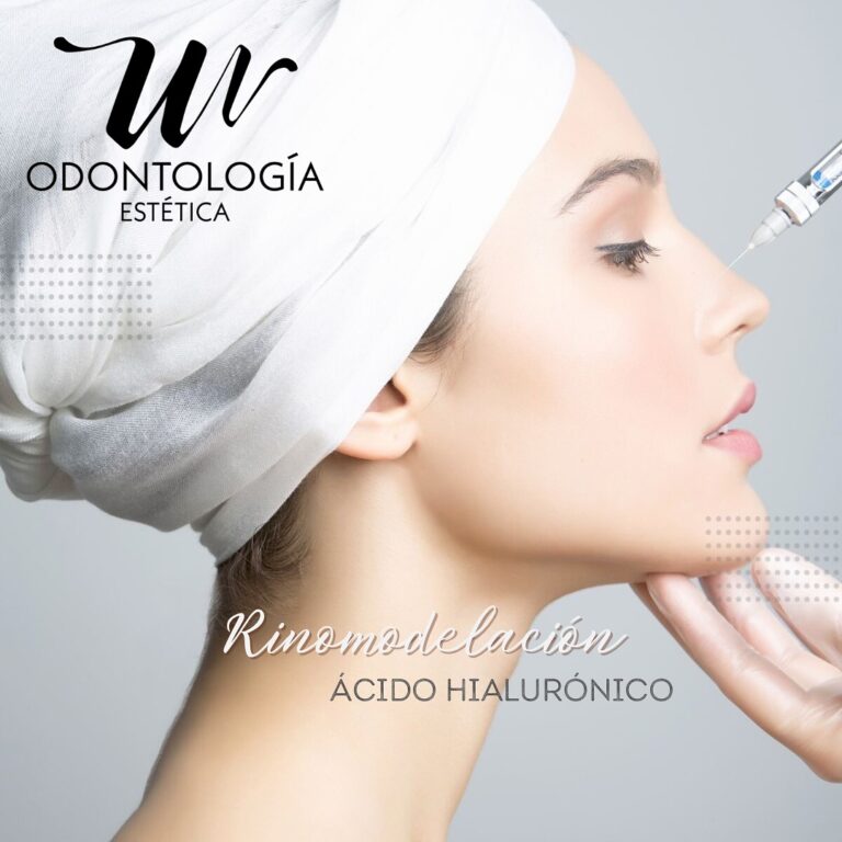 wo_acido_hialuronico