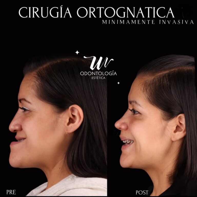 wo_cirujia_ortognatica