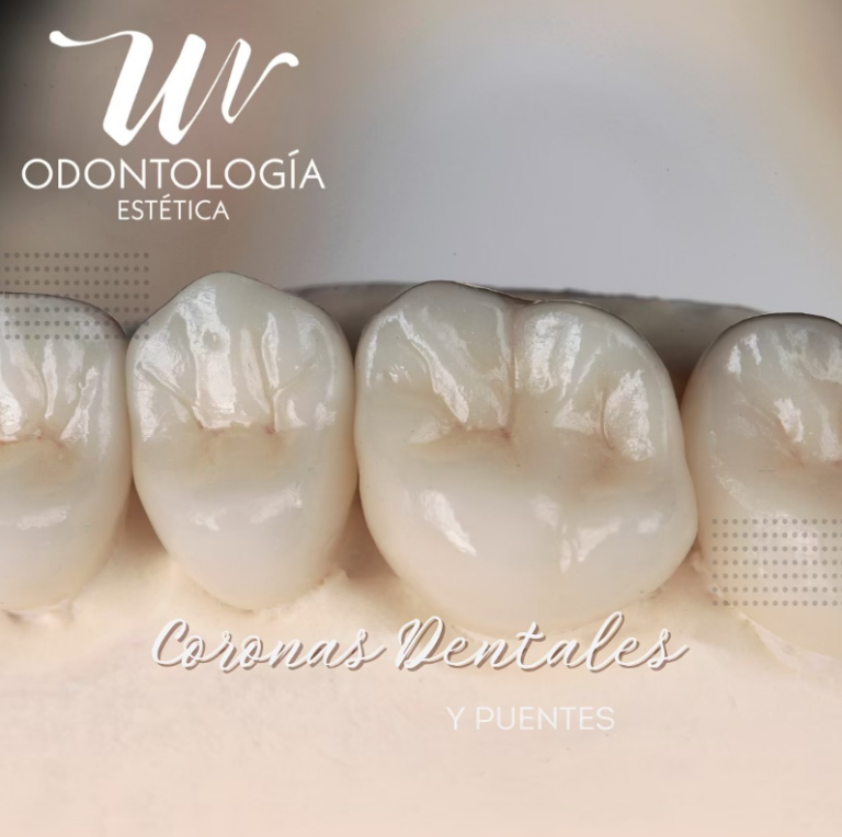 wo_coronas_dentales