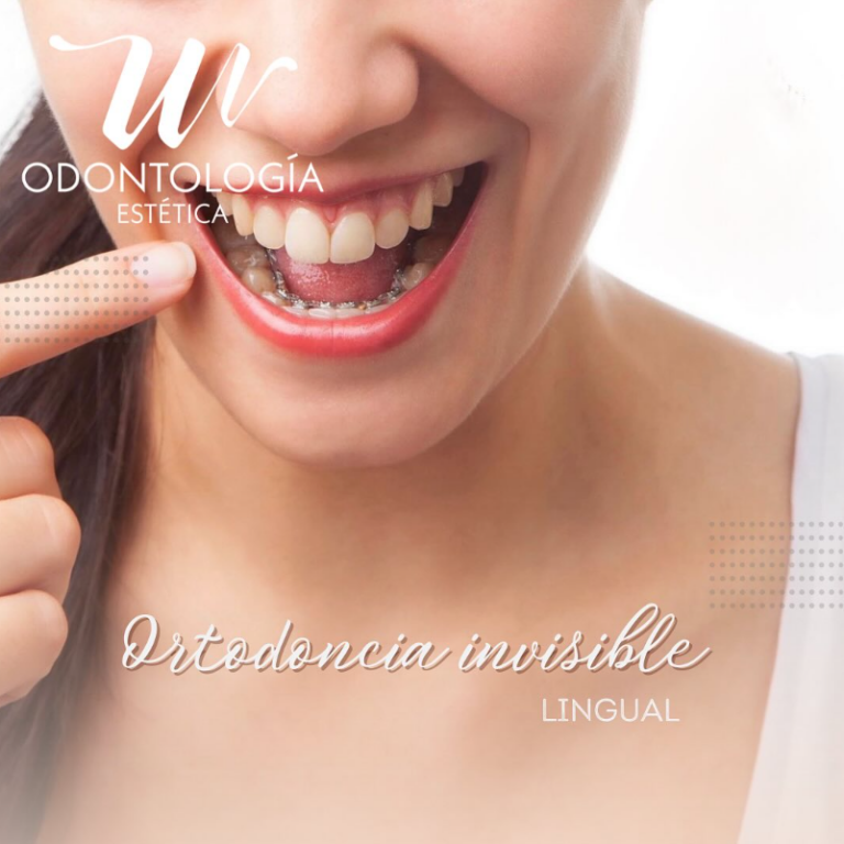 wo_ortodoncia_invisible