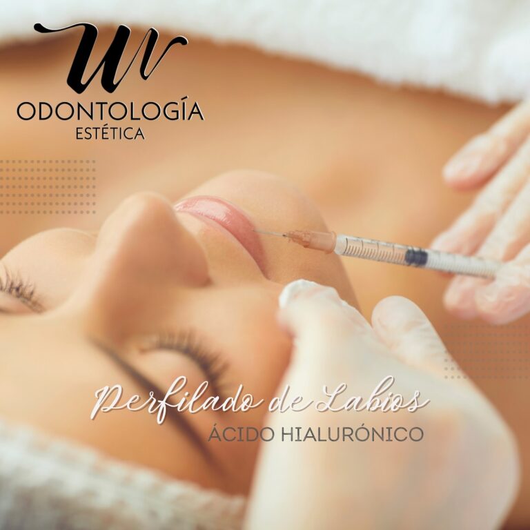 wo_perfilado_de_labios